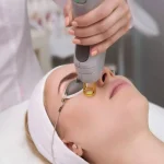 trattamento con laser co2 glass