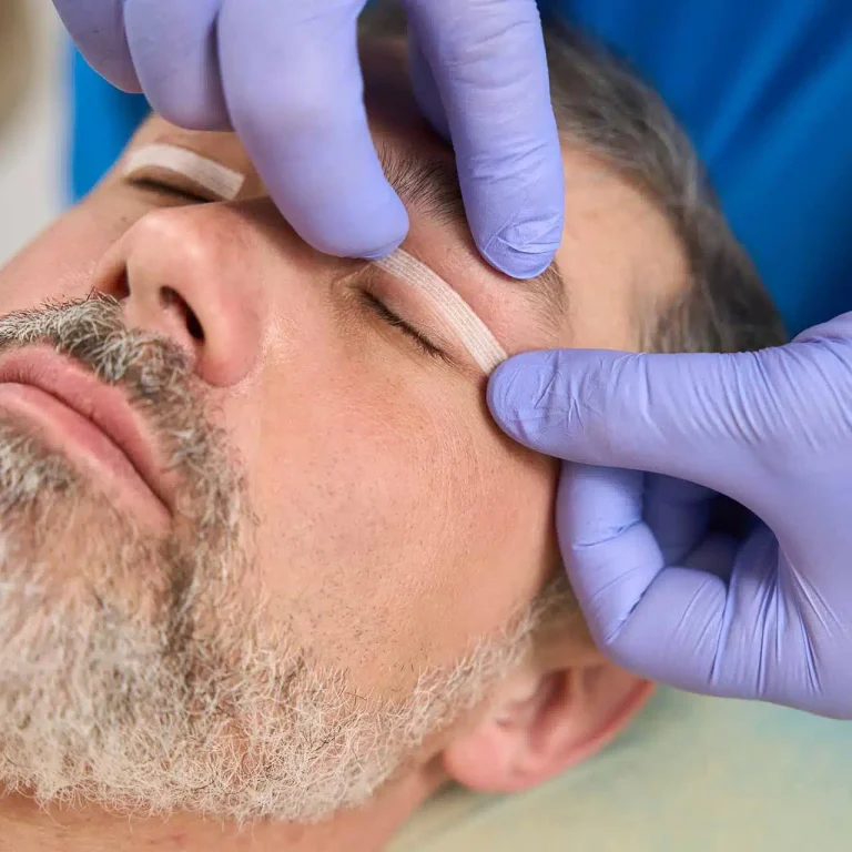 blefaroplastica aurial