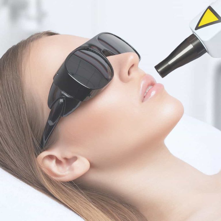 Laser Fotoringiovanimento