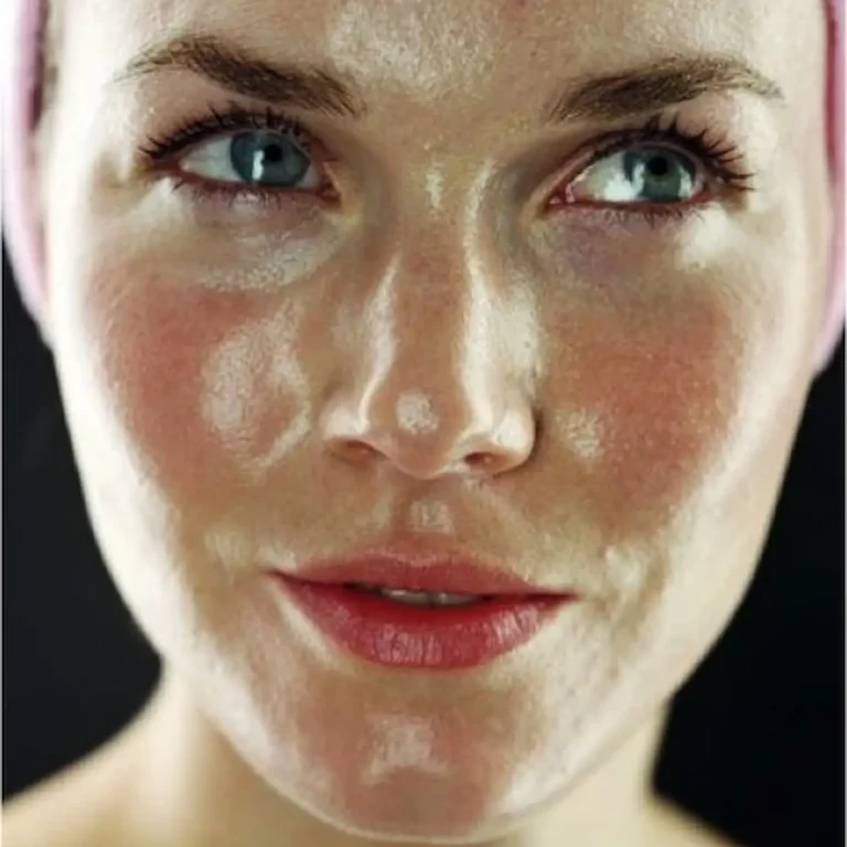 viso di una donna con pelle grassa
