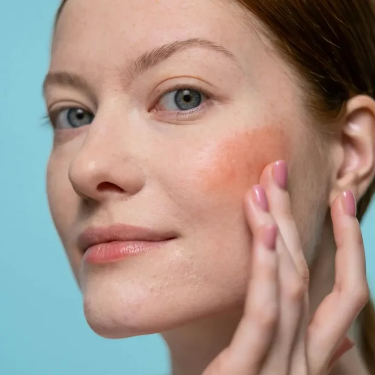 Viso con rossore dovuto da presenza di rosacea